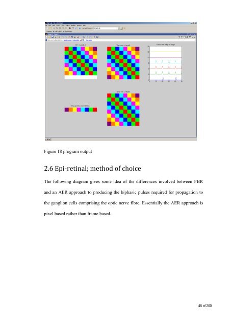 Retinal Prosthesis Dissertation - Student Home Pages