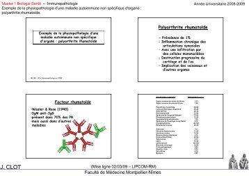 Polyarthrite rhumatoïde - Faculté de médecine de Montpellier