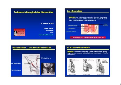 Traitement chirurgical des Hémorroïdes