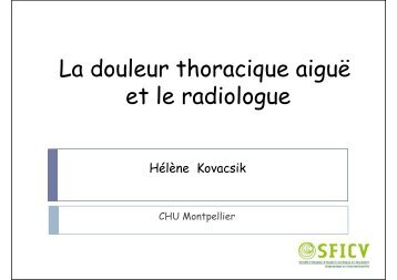 La douleur thoracique aiguë et le radiologue