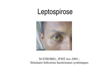 Leptospirose - (1.4 Mo)