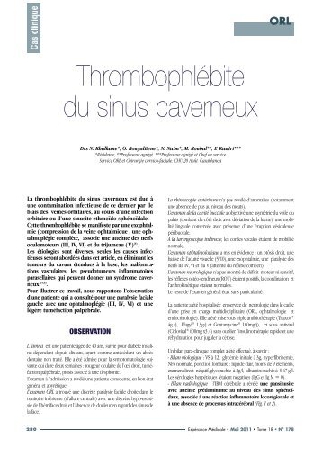 ThrombophlÃ©bite du sinus caverneux - Pharmacies.ma