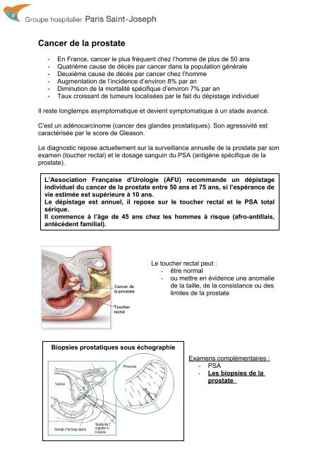 les causes de la maladie de la prostate chez lhomme les causes de la maladie de la prostate chez lhomme