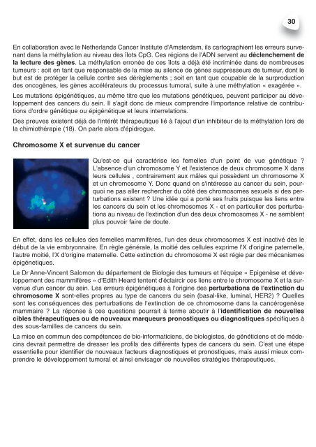 Cancers du Sein - Institut Curie