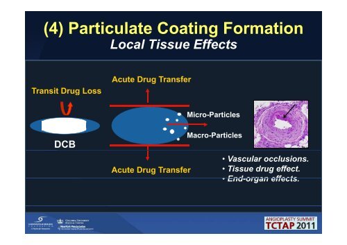 Drug Eluting Balloons will Drug-Eluting Balloons ... - summitMD.com