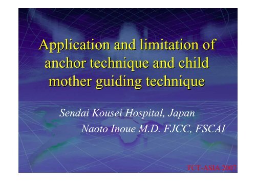 Application and limitation of anchor technique and ... - summitMD.com