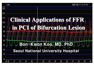 Clinical Applications of FFR in PCI of Bifurcation ... - summitMD.com