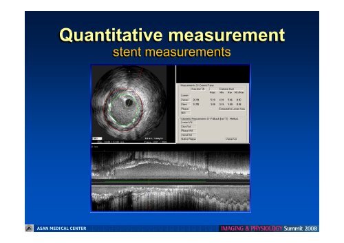 Quantitative measurement - summitMD.com