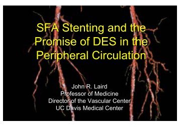 SFA Stenting and the Promise of DES in the ... - summitMD.com