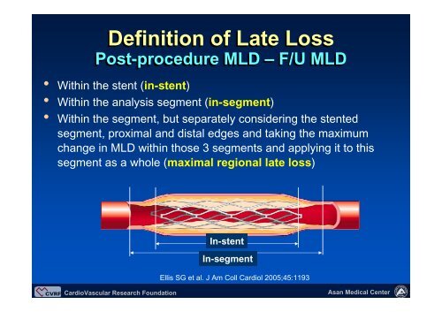 In-segment late loss - summitMD.com