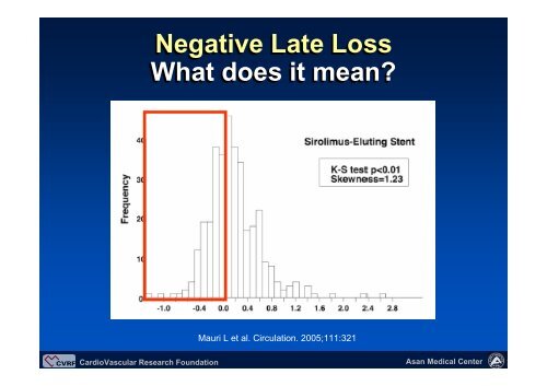 In-segment late loss - summitMD.com