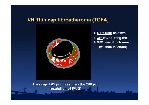 Attenuated Plaque - summitMD.com