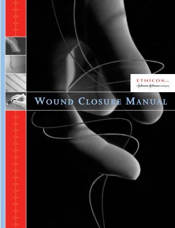 Stitching Wounds-When There is No Hospital Wound-closure-manual-pdf-penn-medicine