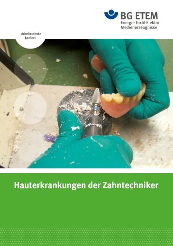 Hauterkrankungen der Zahntechniker - Die BG ETEM