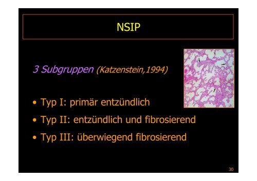 Interstitielle Pneumonie - Diagnostikum Graz