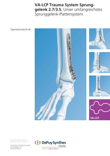 VA-LCP Trauma System Sprung- gelenk 2.7/3.5. Unser ...