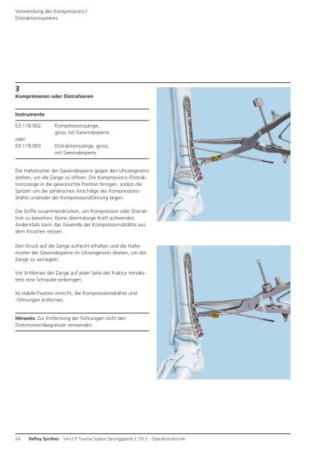 VA-LCP Trauma System Sprung- gelenk 2.7/3.5. Unser ...