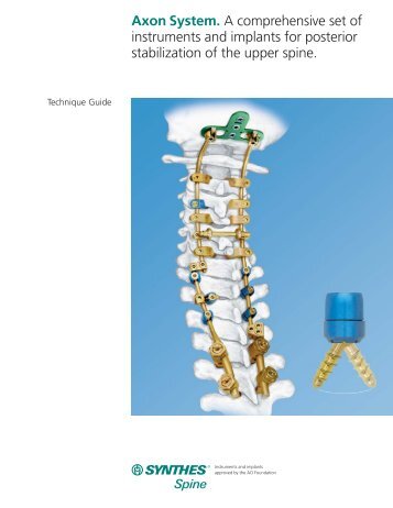 Axon System Technique Guide - Synthes