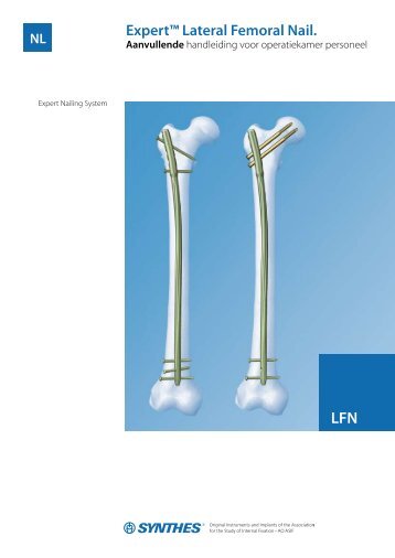 Expert™ Lateral Femoral Nail. - Synthes