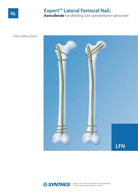 EXPERT™ Cannulated Lateral Entry Femoral Recon Nail | Products | DePuy  Synthes