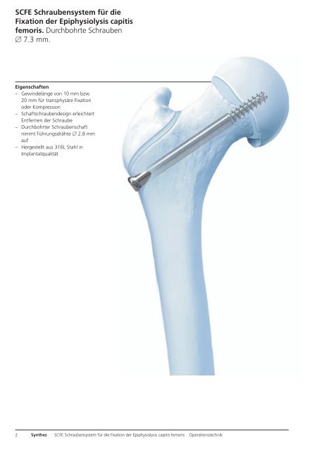 SCFE Schraubensystem für die Fixation der ... - Synthes