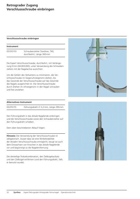 Expert R/AFN. Retrograder / Antegrader Femurnagel. - Synthes