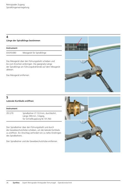 Expert R/AFN. Retrograder / Antegrader Femurnagel. - Synthes