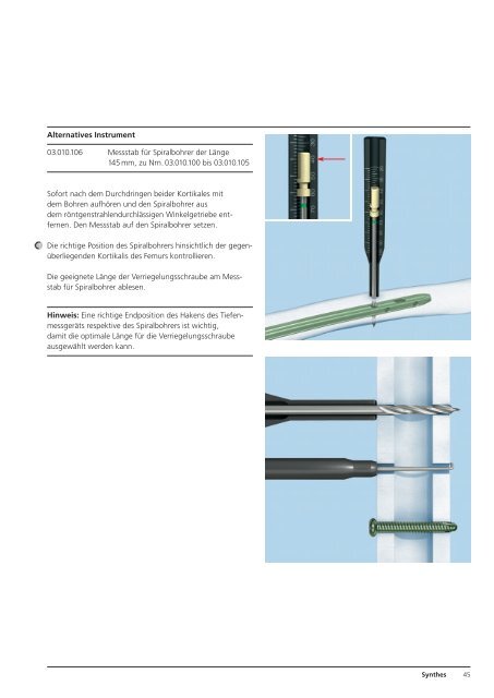 Expert R/AFN. Retrograder / Antegrader Femurnagel. - Synthes