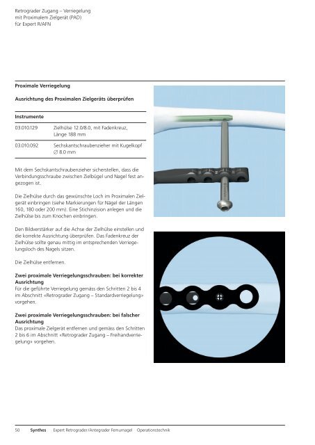 Expert R/AFN. Retrograder / Antegrader Femurnagel. - Synthes