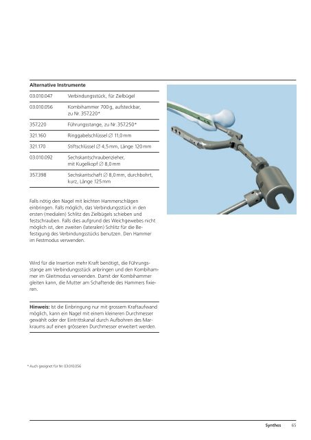 Expert R/AFN. Retrograder / Antegrader Femurnagel. - Synthes