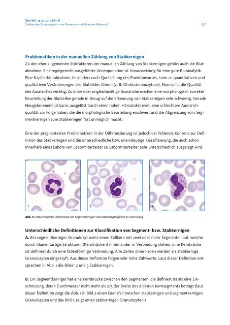 Stabkernige Granulozyten – ein Parameter mit klinischer Relevanz?