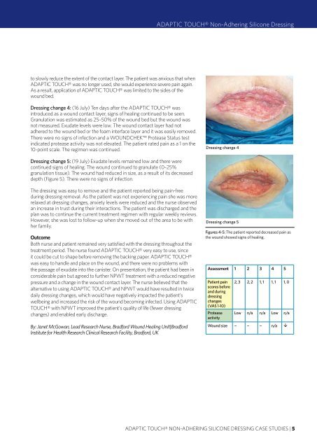 USING ADAPTIC TOUCHÂ® Non-Adhering Silicone ... - Systagenix