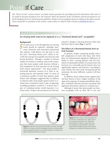 Point of Care - Removable Prosthodontics - Dalhousie University