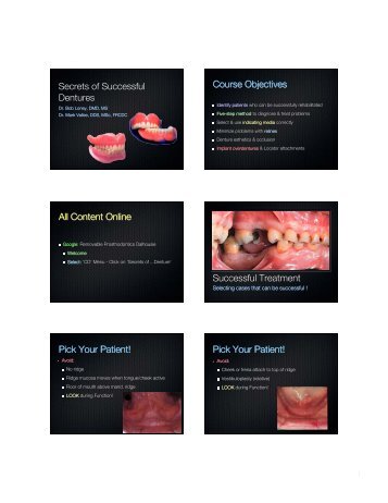 Secrets of Successful Dent 1 - Removable Prosthodontics