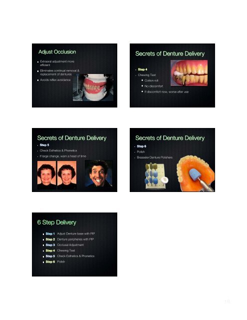 Secrets of Successful Dent 1 - Removable Prosthodontics