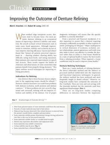 Improving The Outcome Of Denture Relining - Removable ...