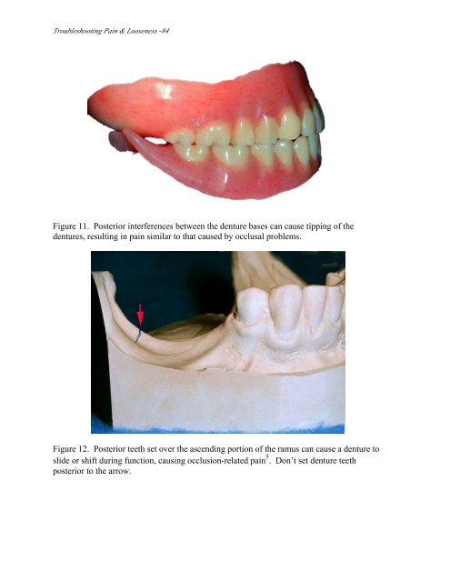 Manuals_files/CD Manual 12.pdf - Removable Prosthodontics