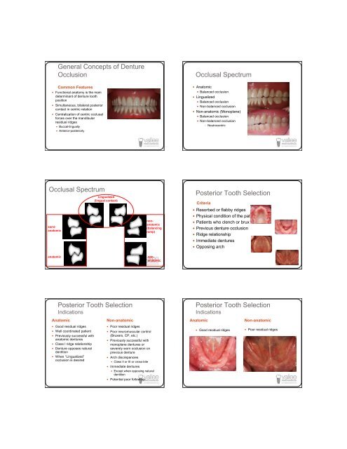 Successful Dentures Part II - Removable Prosthodontics