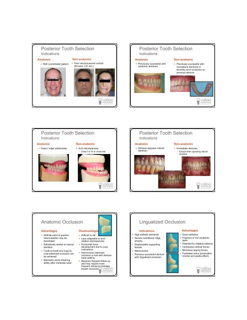 Successful Dentures Part II - Removable Prosthodontics