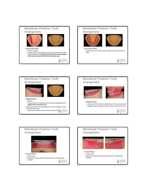 Successful Dentures Part II - Removable Prosthodontics