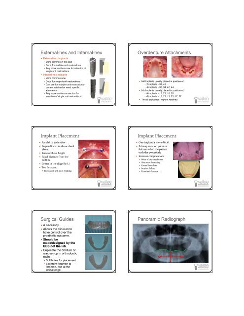 Successful Dentures Part II - Removable Prosthodontics