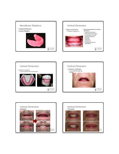 Successful Dentures Part II - Removable Prosthodontics