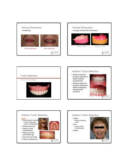 Successful Dentures Part II - Removable Prosthodontics