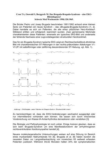 Cron TA, Osswald S, Borggrefe M: Das Brugada ... - Cardio-Med.de