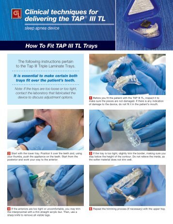 Clinical techniques for delivering the TAPÂ® III TL - Glidewell Dental ...