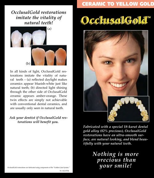 OcclusalGold Glidewell Dental Labs