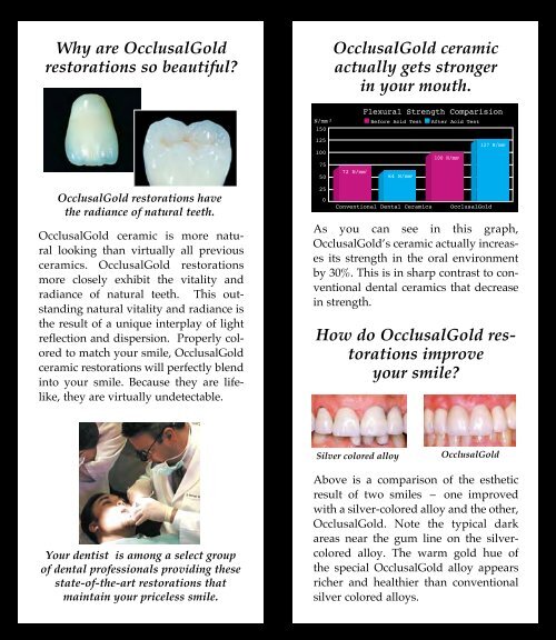 OcclusalGold - Glidewell Dental Labs