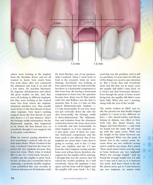 PDF Download - Glidewell Dental Labs