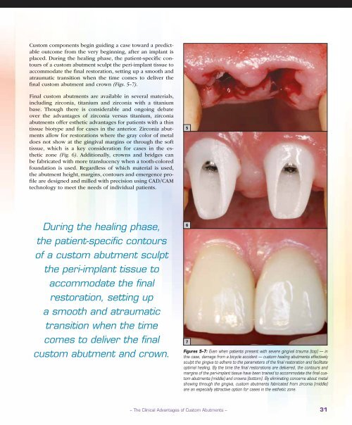 PDF Download - Glidewell Dental Labs