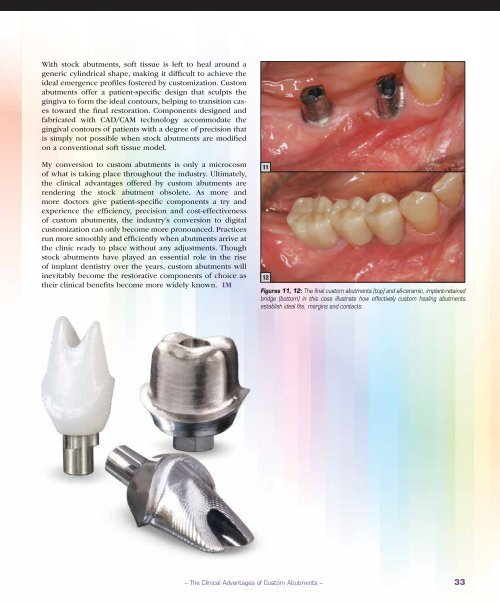 PDF Download - Glidewell Dental Labs